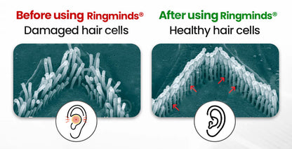 Ringminds® NeuroPulse Silence Pro