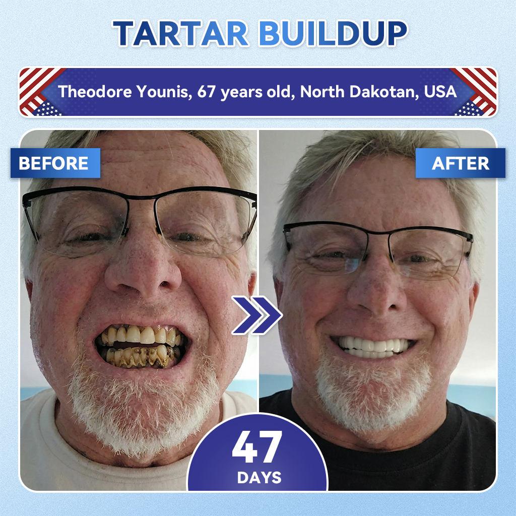 Your Smile~ KLENIMORE™ 🦷 Tideglusib Fast‑Dissolving Tooth & Gum Repair Oral Strips ✨ (𝟓-𝐢𝐧-𝟏 💎 𝐑𝐞𝐛𝐮𝐢𝐥𝐝 𝐄𝐧𝐚𝐦𝐞𝐥 & 𝐃𝐞𝐧𝐭𝐢𝐧 • 𝐒𝐭𝐫𝐞𝐧𝐠𝐭𝐡𝐞𝐧 𝐆𝐮𝐦𝐬 • 𝐄𝐫𝐚𝐝𝐢𝐜𝐚𝐭𝐞 𝐓𝐚𝐫𝐭𝐚𝐫 & 𝐎𝐝𝐨𝐫 • 𝐖𝐡𝐢𝐭𝐞𝐧𝐢𝐧𝐠 • 𝐒𝐭𝐨𝐩 𝐓𝐨𝐨𝐭𝐡 𝐒𝐞𝐧𝐬𝐢𝐭𝐢𝐯𝐢𝐭𝐲)
