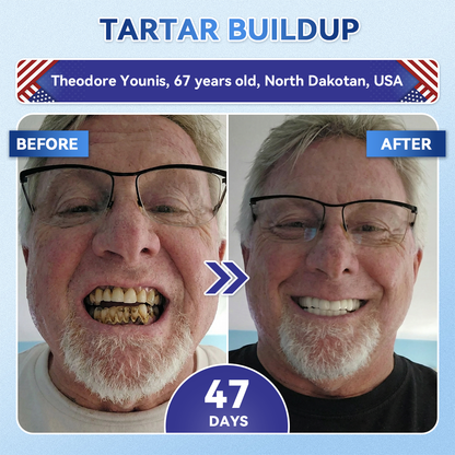 Your Smile~ KLENIMORE™ 🦷 Tideglusib Fast‑Dissolving Tooth & Gum Repair Oral Strips ✨ (𝟓-𝐢𝐧-𝟏 💎 𝐑𝐞𝐛𝐮𝐢𝐥𝐝 𝐄𝐧𝐚𝐦𝐞𝐥 & 𝐃𝐞𝐧𝐭𝐢𝐧 • 𝐒𝐭𝐫𝐞𝐧𝐠𝐭𝐡𝐞𝐧 𝐆𝐮𝐦𝐬 • 𝐄𝐫𝐚𝐝𝐢𝐜𝐚𝐭𝐞 𝐓𝐚𝐫𝐭𝐚𝐫 & 𝐎𝐝𝐨𝐫 • 𝐖𝐡𝐢𝐭𝐞𝐧𝐢𝐧𝐠 • 𝐒𝐭𝐨𝐩 𝐓𝐨𝐨𝐭𝐡 𝐒𝐞𝐧𝐬𝐢𝐭𝐢𝐯𝐢𝐭𝐲)