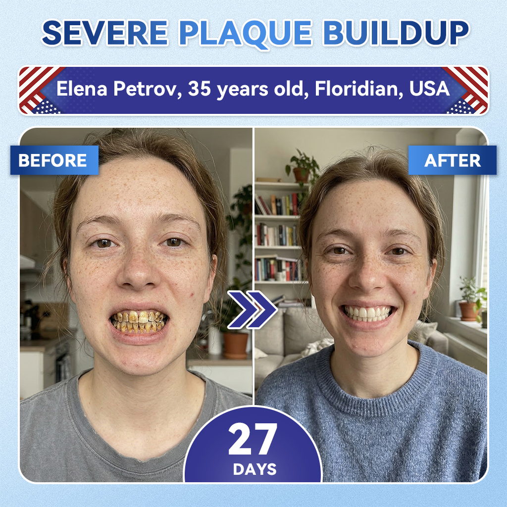 Your Smile~ KLENIMORE™ 🦷 Tideglusib Fast‑Dissolving Tooth & Gum Repair Oral Strips ✨ (𝟓-𝐢𝐧-𝟏 💎 𝐑𝐞𝐛𝐮𝐢𝐥𝐝 𝐄𝐧𝐚𝐦𝐞𝐥 & 𝐃𝐞𝐧𝐭𝐢𝐧 • 𝐒𝐭𝐫𝐞𝐧𝐠𝐭𝐡𝐞𝐧 𝐆𝐮𝐦𝐬 • 𝐄𝐫𝐚𝐝𝐢𝐜𝐚𝐭𝐞 𝐓𝐚𝐫𝐭𝐚𝐫 & 𝐎𝐝𝐨𝐫 • 𝐖𝐡𝐢𝐭𝐞𝐧𝐢𝐧𝐠 • 𝐒𝐭𝐨𝐩 𝐓𝐨𝐨𝐭𝐡 𝐒𝐞𝐧𝐬𝐢𝐭𝐢𝐯𝐢𝐭𝐲)