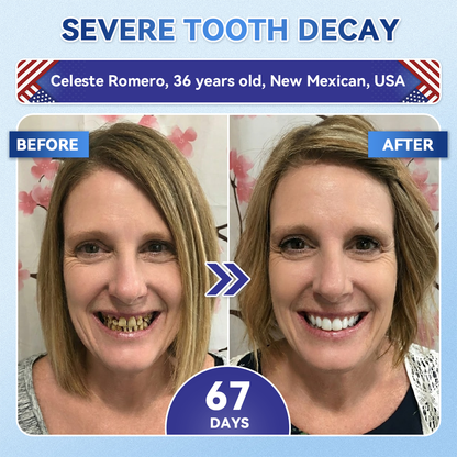 Your Smile~ KLENIMORE™ 🦷 Tideglusib Fast‑Dissolving Tooth & Gum Repair Oral Strips ✨ (𝟓-𝐢𝐧-𝟏 💎 𝐑𝐞𝐛𝐮𝐢𝐥𝐝 𝐄𝐧𝐚𝐦𝐞𝐥 & 𝐃𝐞𝐧𝐭𝐢𝐧 • 𝐒𝐭𝐫𝐞𝐧𝐠𝐭𝐡𝐞𝐧 𝐆𝐮𝐦𝐬 • 𝐄𝐫𝐚𝐝𝐢𝐜𝐚𝐭𝐞 𝐓𝐚𝐫𝐭𝐚𝐫 & 𝐎𝐝𝐨𝐫 • 𝐖𝐡𝐢𝐭𝐞𝐧𝐢𝐧𝐠 • 𝐒𝐭𝐨𝐩 𝐓𝐨𝐨𝐭𝐡 𝐒𝐞𝐧𝐬𝐢𝐭𝐢𝐯𝐢𝐭𝐲)