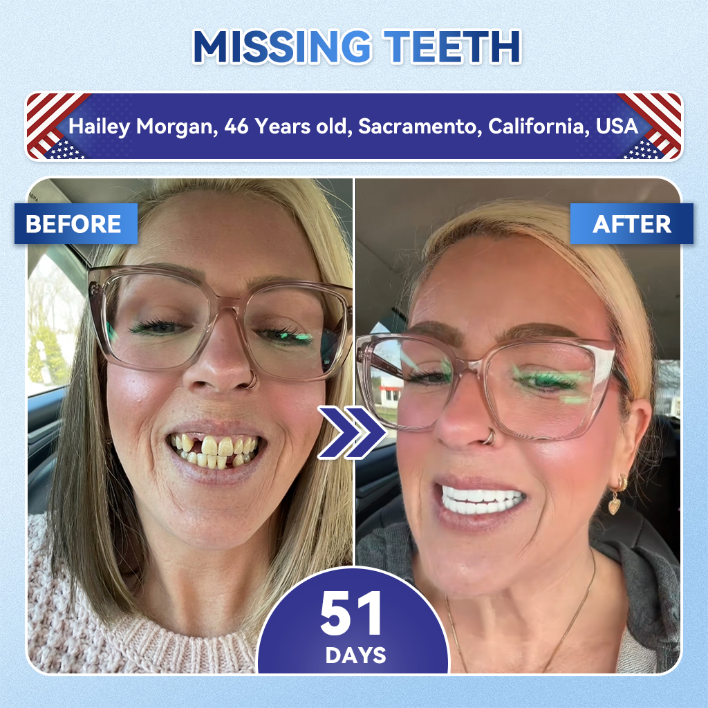 Your Smile~ KLENIMORE™ 🦷 Tideglusib Fast‑Dissolving Tooth & Gum Repair Oral Strips ✨ (𝟓-𝐢𝐧-𝟏 💎 𝐑𝐞𝐛𝐮𝐢𝐥𝐝 𝐄𝐧𝐚𝐦𝐞𝐥 & 𝐃𝐞𝐧𝐭𝐢𝐧 • 𝐒𝐭𝐫𝐞𝐧𝐠𝐭𝐡𝐞𝐧 𝐆𝐮𝐦𝐬 • 𝐄𝐫𝐚𝐝𝐢𝐜𝐚𝐭𝐞 𝐓𝐚𝐫𝐭𝐚𝐫 & 𝐎𝐝𝐨𝐫 • 𝐖𝐡𝐢𝐭𝐞𝐧𝐢𝐧𝐠 • 𝐒𝐭𝐨𝐩 𝐓𝐨𝐨𝐭𝐡 𝐒𝐞𝐧𝐬𝐢𝐭𝐢𝐯𝐢𝐭𝐲)