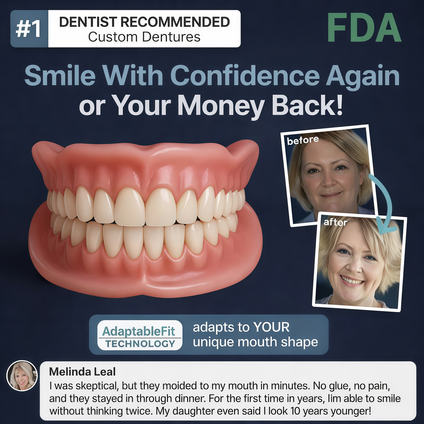 2026🏆✨LAST DAY SALE 70% OFF🔥 Newly upgraded second-generation BRONY™ complete dentures